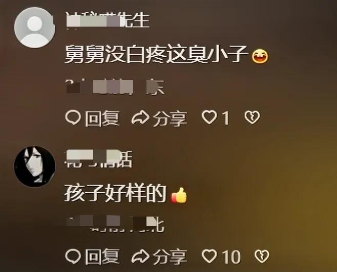 男子用3D打印幫舅舅補上斷指
