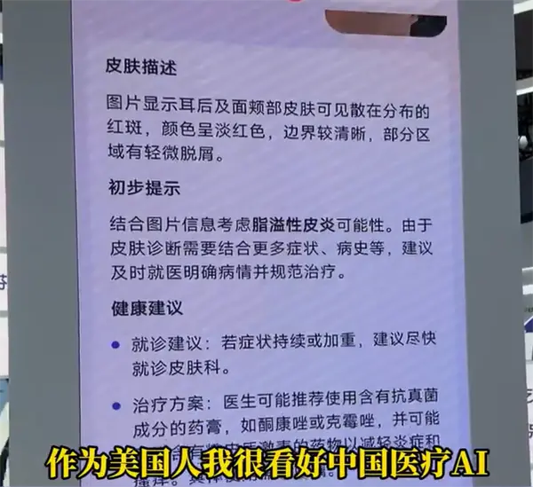 博主坦言美國(guó)看病太貴太麻煩：想把中國(guó)的AI醫(yī)生帶回去